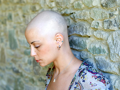 Уход за волосами после химиотерапии Уход за волосами после химиотерапии