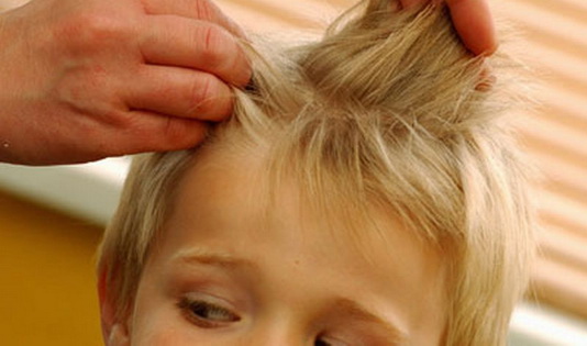 Как безопасно избавиться от гнид у ребенка в домашних условиях Как избавиться от гнид у ребенка в домашних условиях
