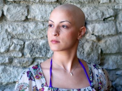 Как восстановить волосы после химиотерапии