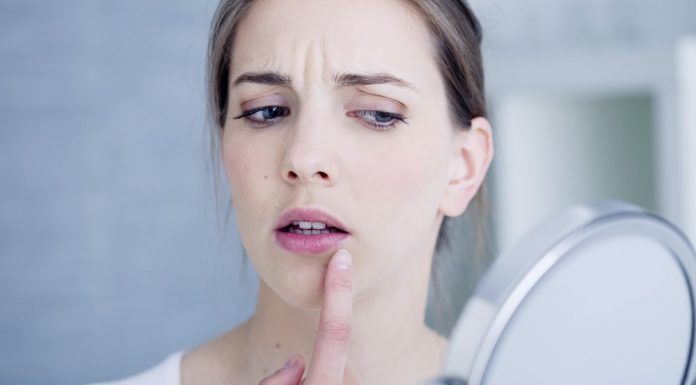 Гранулы Фордайса: болезнь или анатомическая особенность?