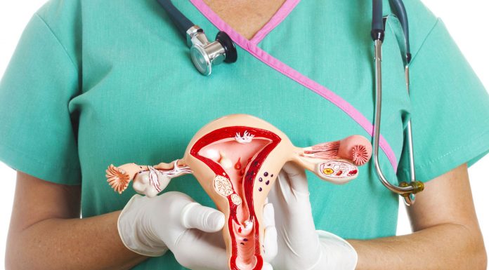 Лечение рака яичников в Израиле