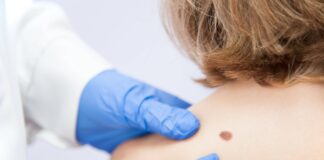 Причины и симптомы появления бородавок