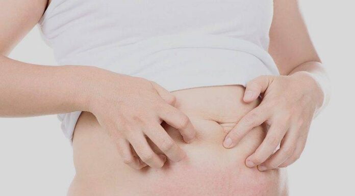 Дерматоз и кожные изменения при беременности