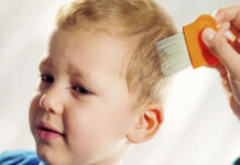 Родителям на заметку: правда о вшах и их лечении