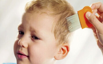 Родителям на заметку: правда о вшах и их лечении