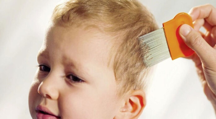 Родителям на заметку: правда о вшах и их лечении