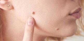 Где качественно удалить бородавки: что это, типы бородавок, причины появления, способы удаления и особенности избавления от бородавок