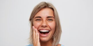 Стоит ли устанавливать керамические брекеты детям: что это, когда требуется установка брекетов, особенности коррекции, плюсы керамических брекетов