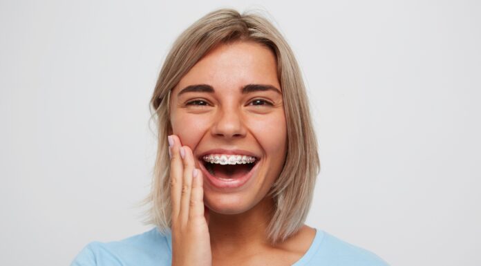 Стоит ли устанавливать керамические брекеты детям: что это, когда требуется установка брекетов, особенности коррекции, плюсы керамических брекетов