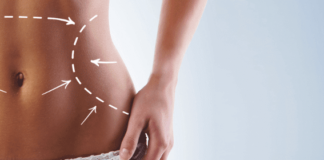 Плюсы и минусы липоскульптуры