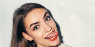 Зубные брекеты для получения здоровых зубов