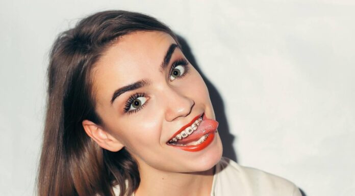 Зубные брекеты для получения здоровых зубов