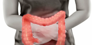 Как выполняются диагностики язвенного колита: что нужно знать о болезни