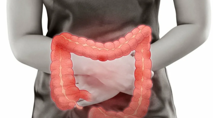 Как выполняются диагностики язвенного колита: что нужно знать о болезни