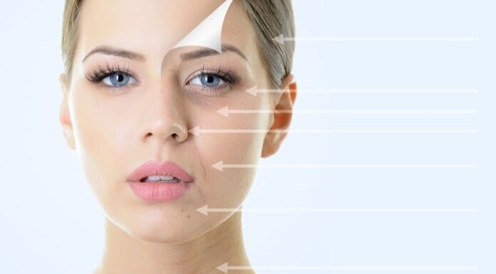 Пилинг Джесснера