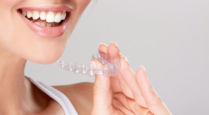 Элайнеры — ваш надежный путь к идеальной улыбке