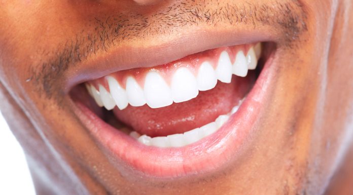 Красивые зубы: отбеливание, пломбирование, брекеты