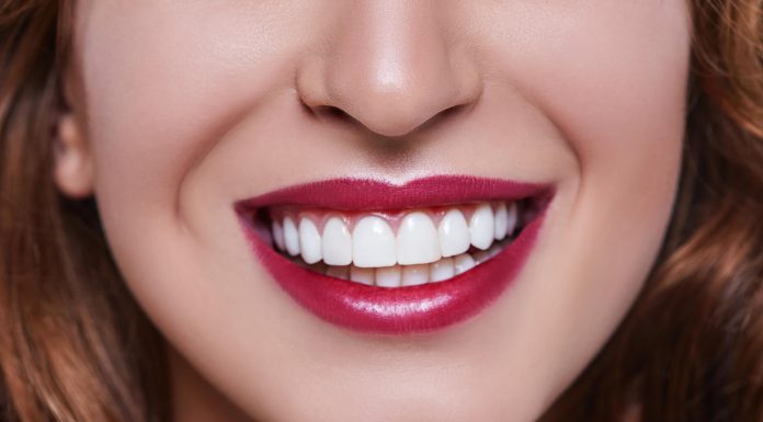 Зубная имплантация: как поразить красивой улыбкой всех