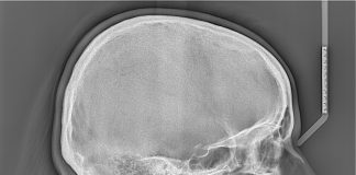 Телерентгенография: что это за метод исследования и зачем он нужен