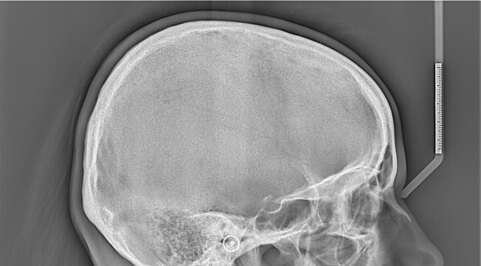 Телерентгенография: что это за метод исследования и зачем он нужен