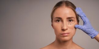 Блефаропластика: что это такое и что нужно знать