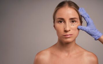 Блефаропластика: что это такое и что нужно знать