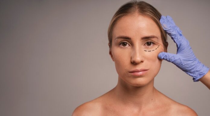 Блефаропластика: что это такое и что нужно знать