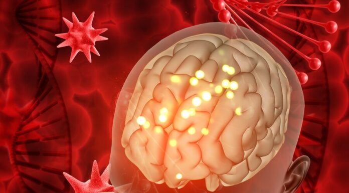 Помощь больным: препараты для пациентов с нарушениями мозгового кровообращения