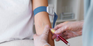 Исследование крови на ТТГ: что это, как проводится и что показывает