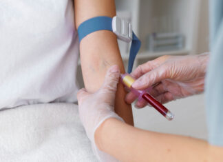 Исследование крови на ТТГ: что это, как проводится и что показывает