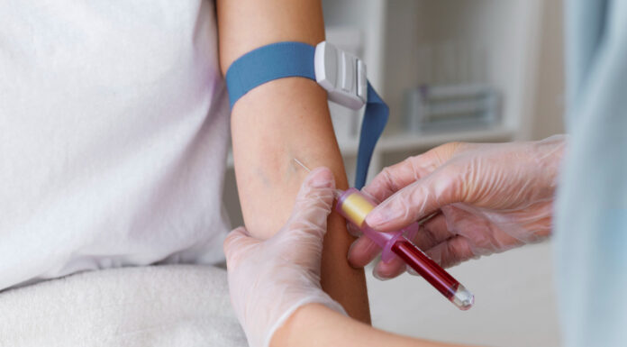 Исследование крови на ТТГ: что это, как проводится и что показывает