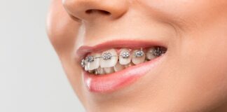 Ортодонтия: исправление прикуса и создание идеальной улыбки