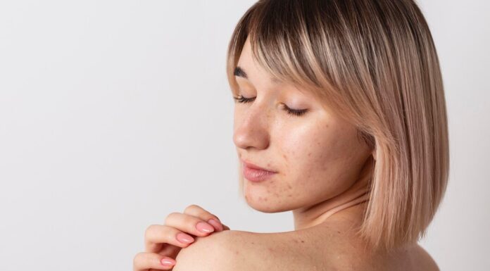 Удаление рубцов и шрамов