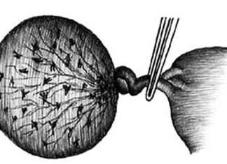 Перекрут ножки кисты яичника: симптомы, диагностика и методы лечения