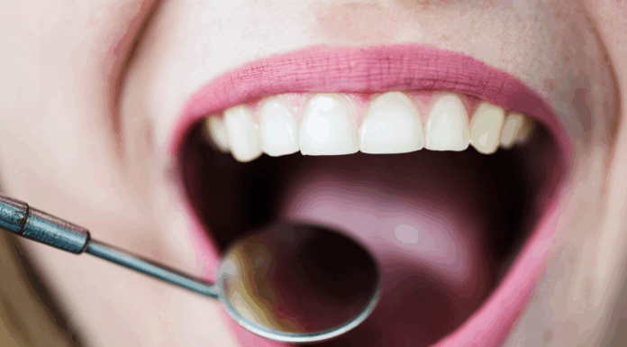 Кюретаж: что за услуга в стоматологии